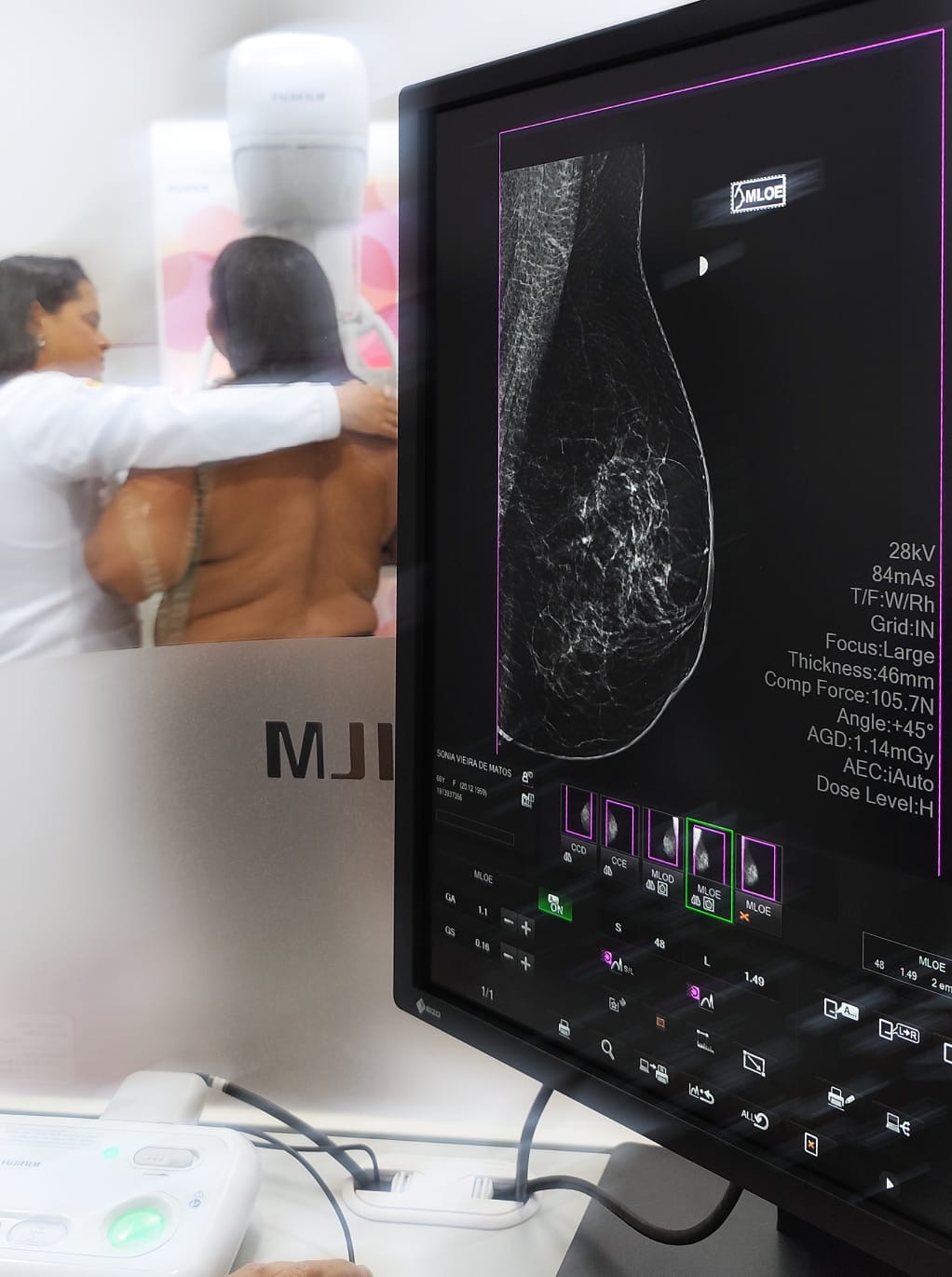 Prefeitura de Itabuna reforça a importância da prevenção e do cuidado com a saúde da mulher no Outubro Rosa